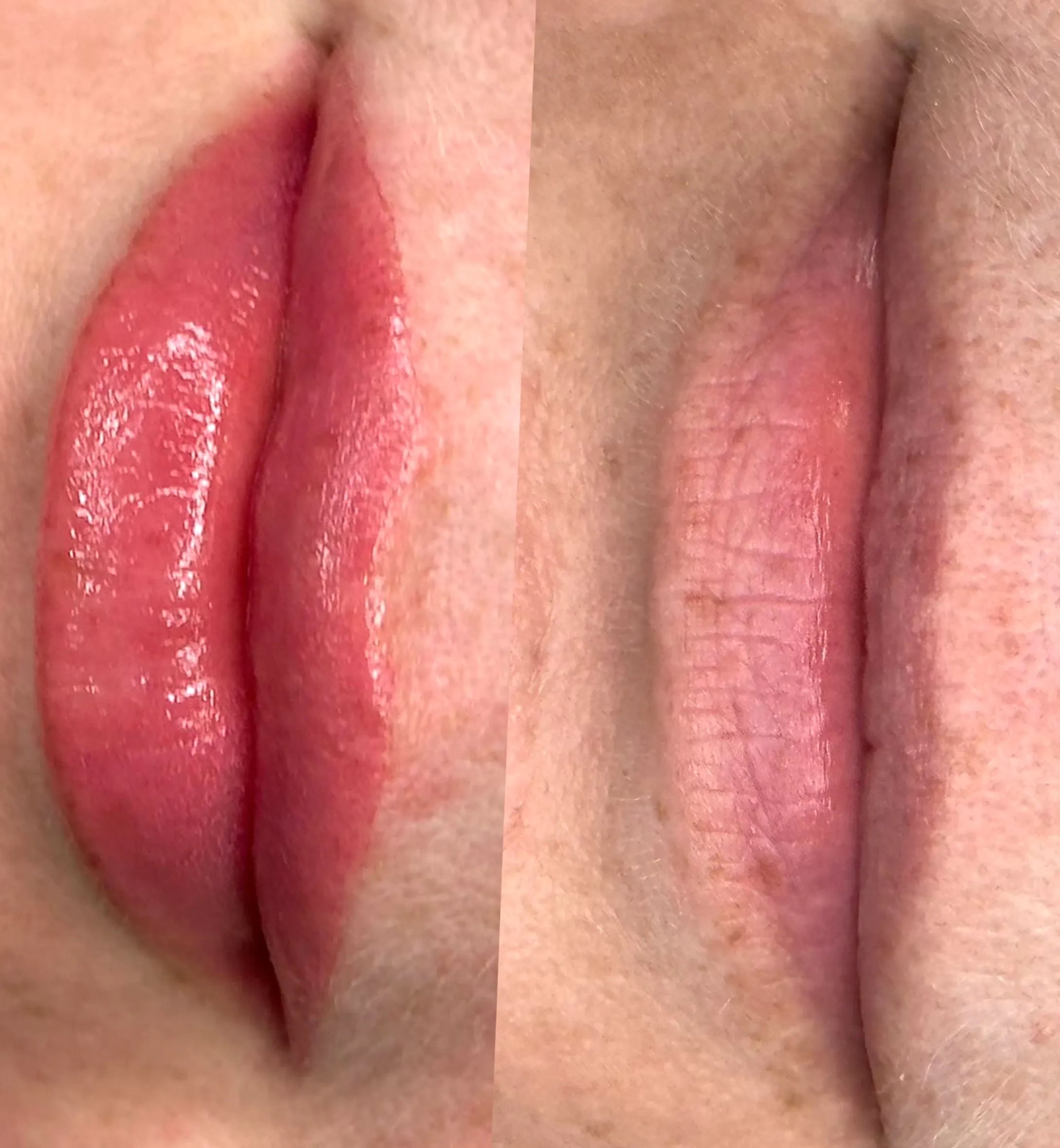 cold sore prevention lip tattoo