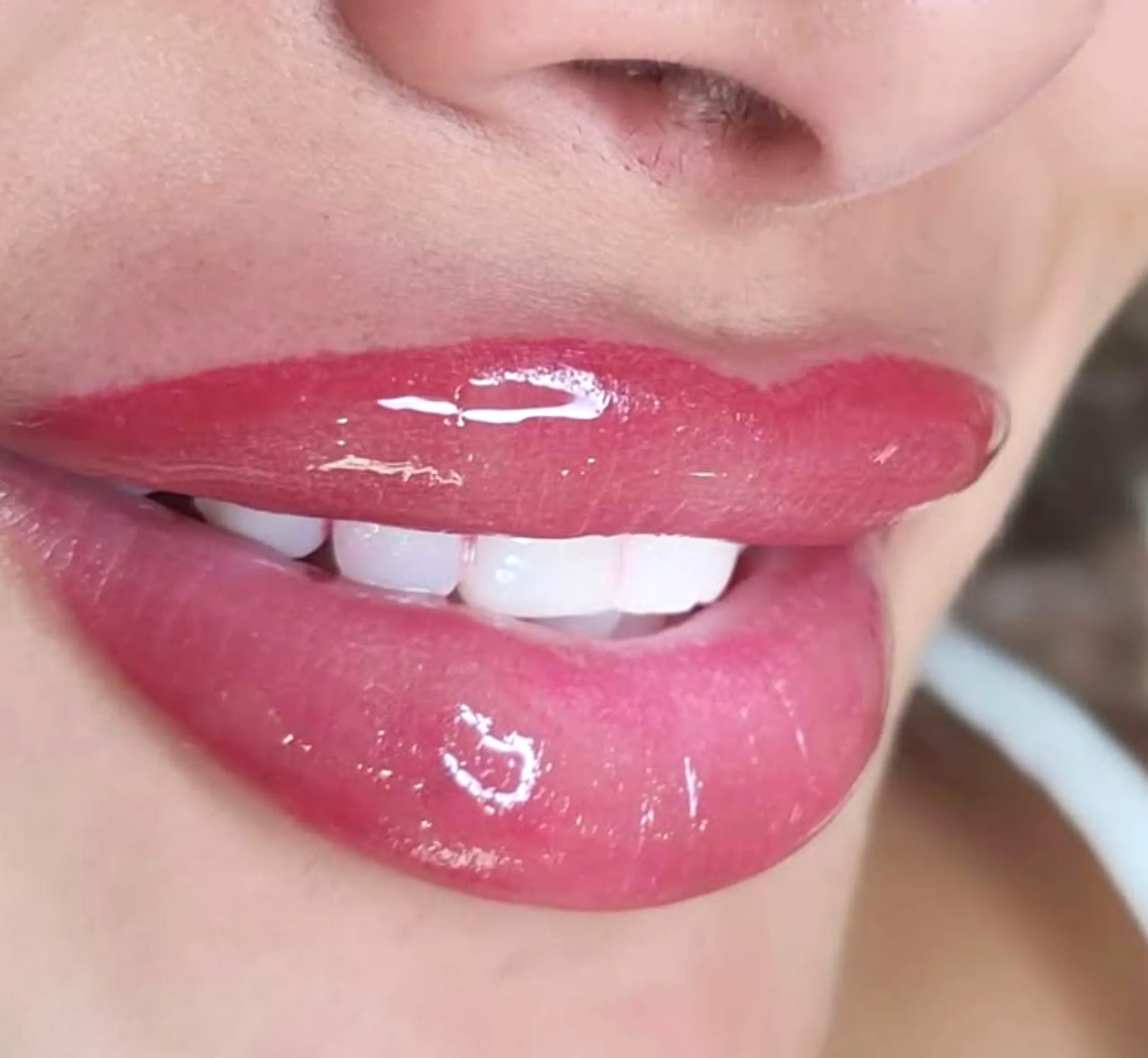 lip blush healing and cold sores